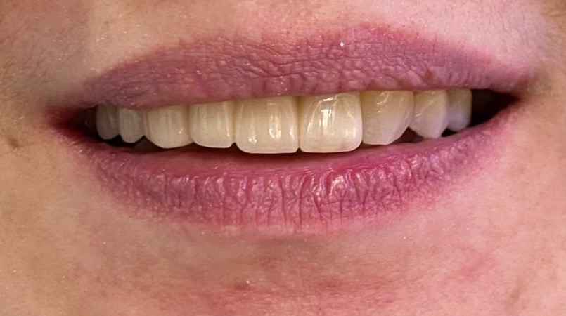 White Line Dental Clinic LLC 5