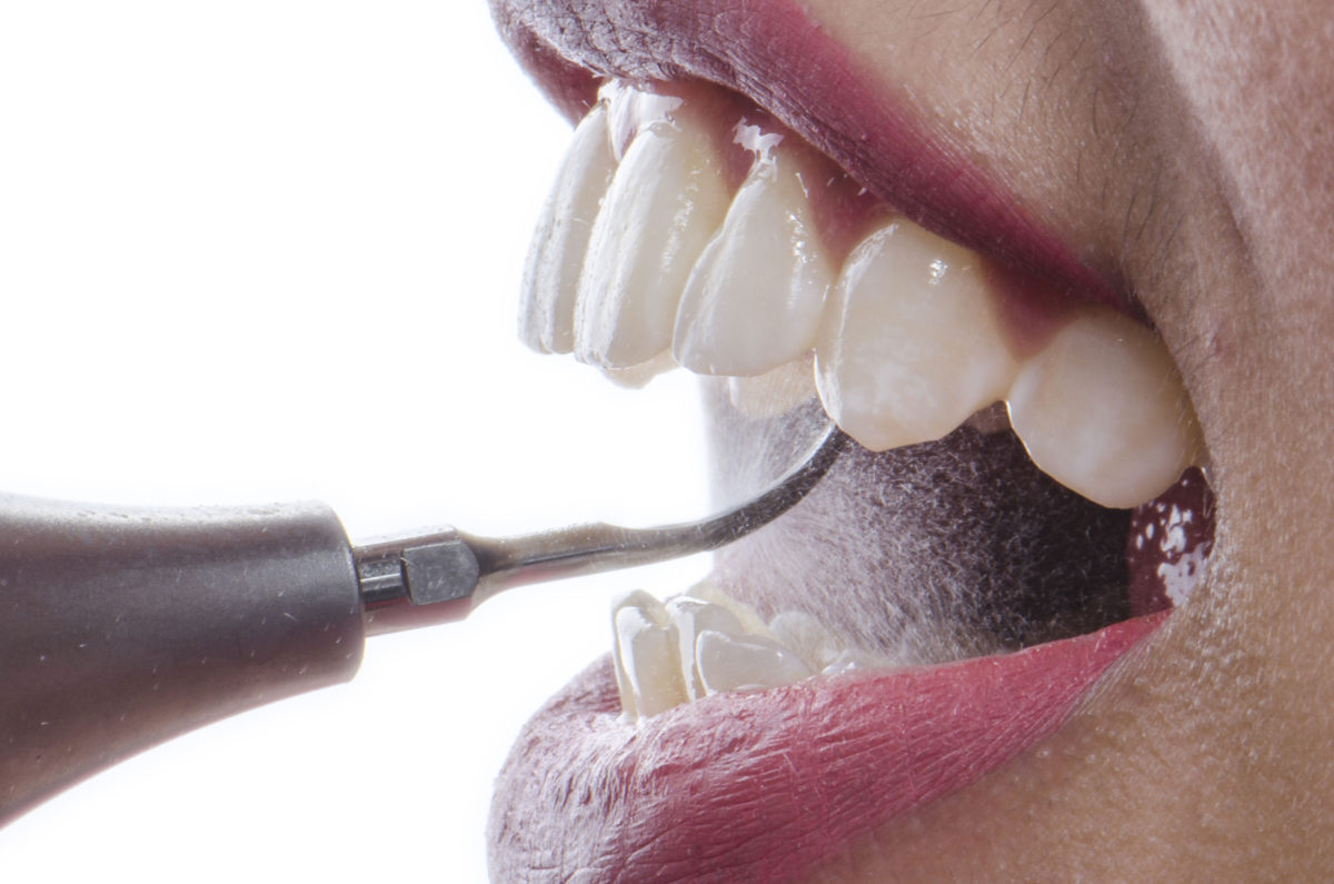 Dr Manoj Kumar - Dentist in Al Barsha