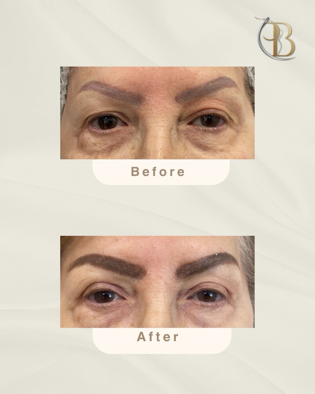 Plastic Surgery By Doctor Punam Bijlani 5