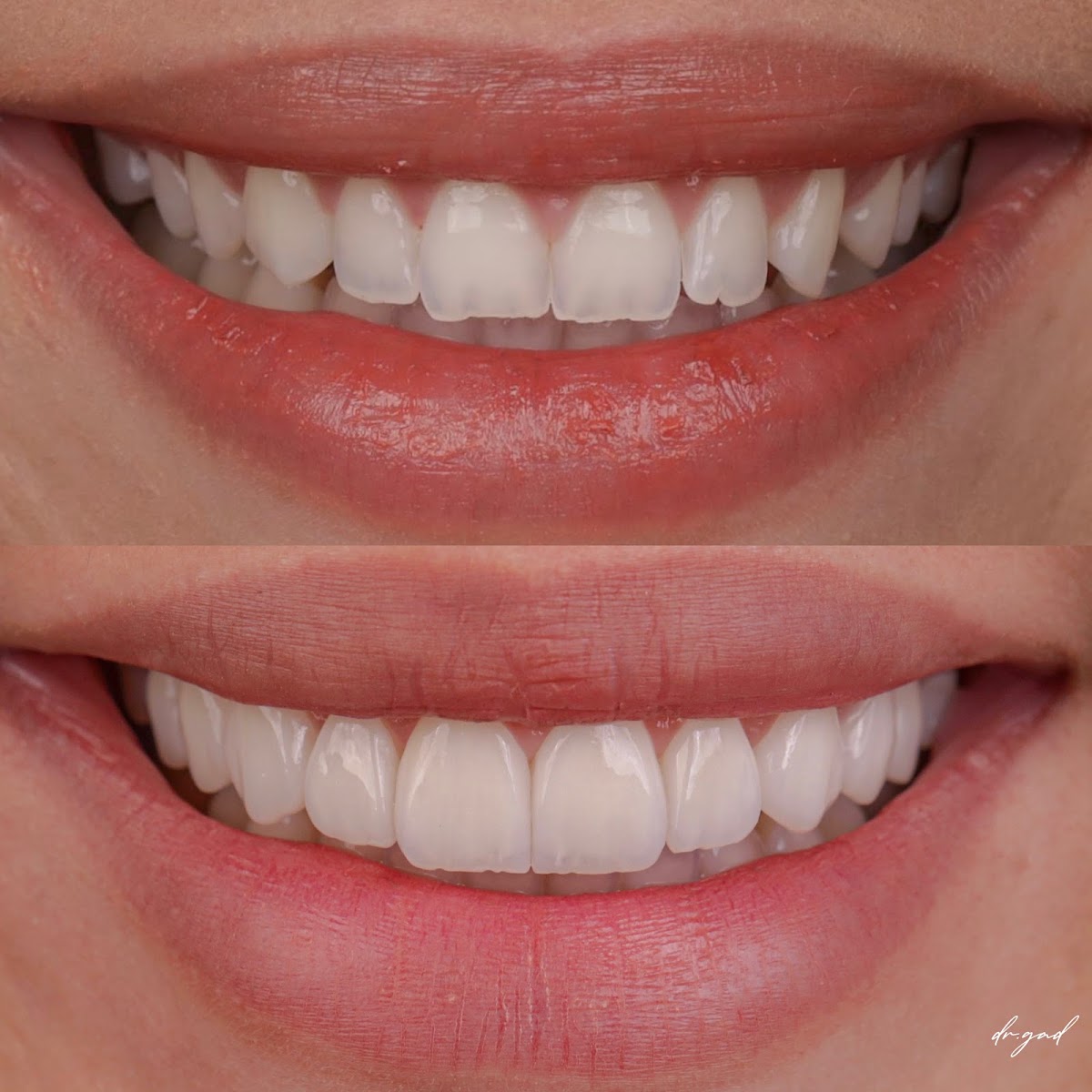 Dr Gad Dental Clinic - Dubai 3