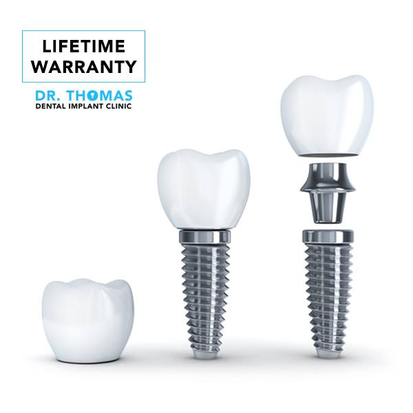 Dr. Thomas Dental Implant Clinic 3
