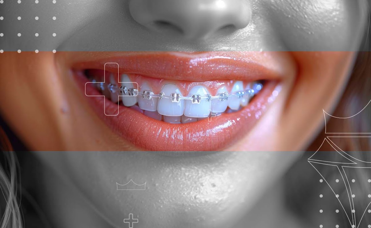 Saphire Dent Clinic Dubai | عيادة سفير دنت لطب الأسنان 5